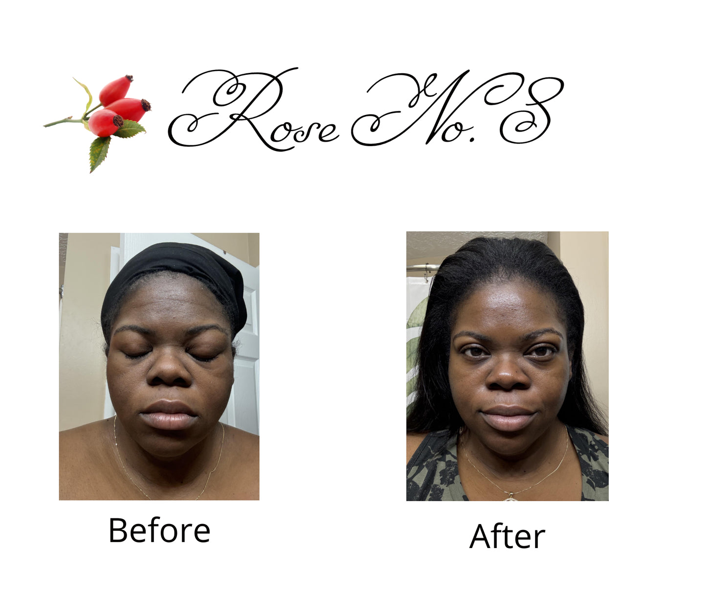 Anti-Aging Facial & Body Oil
