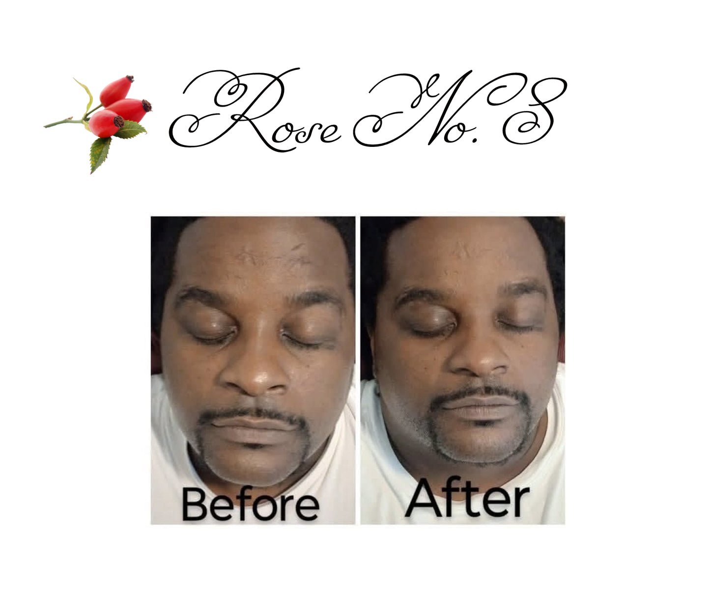 Anti-Aging Facial & Body Oil