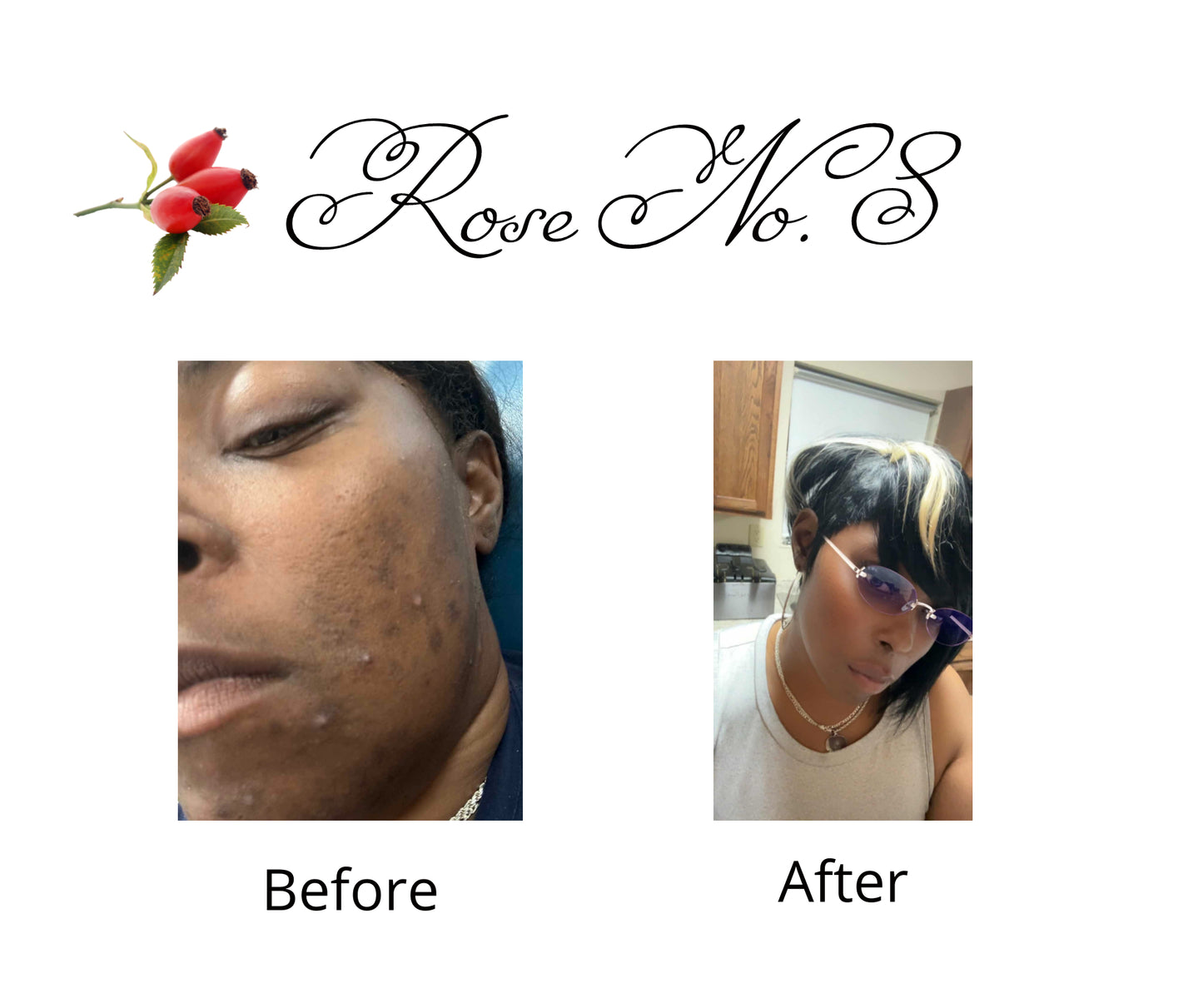 Anti-Aging Facial & Body Oil