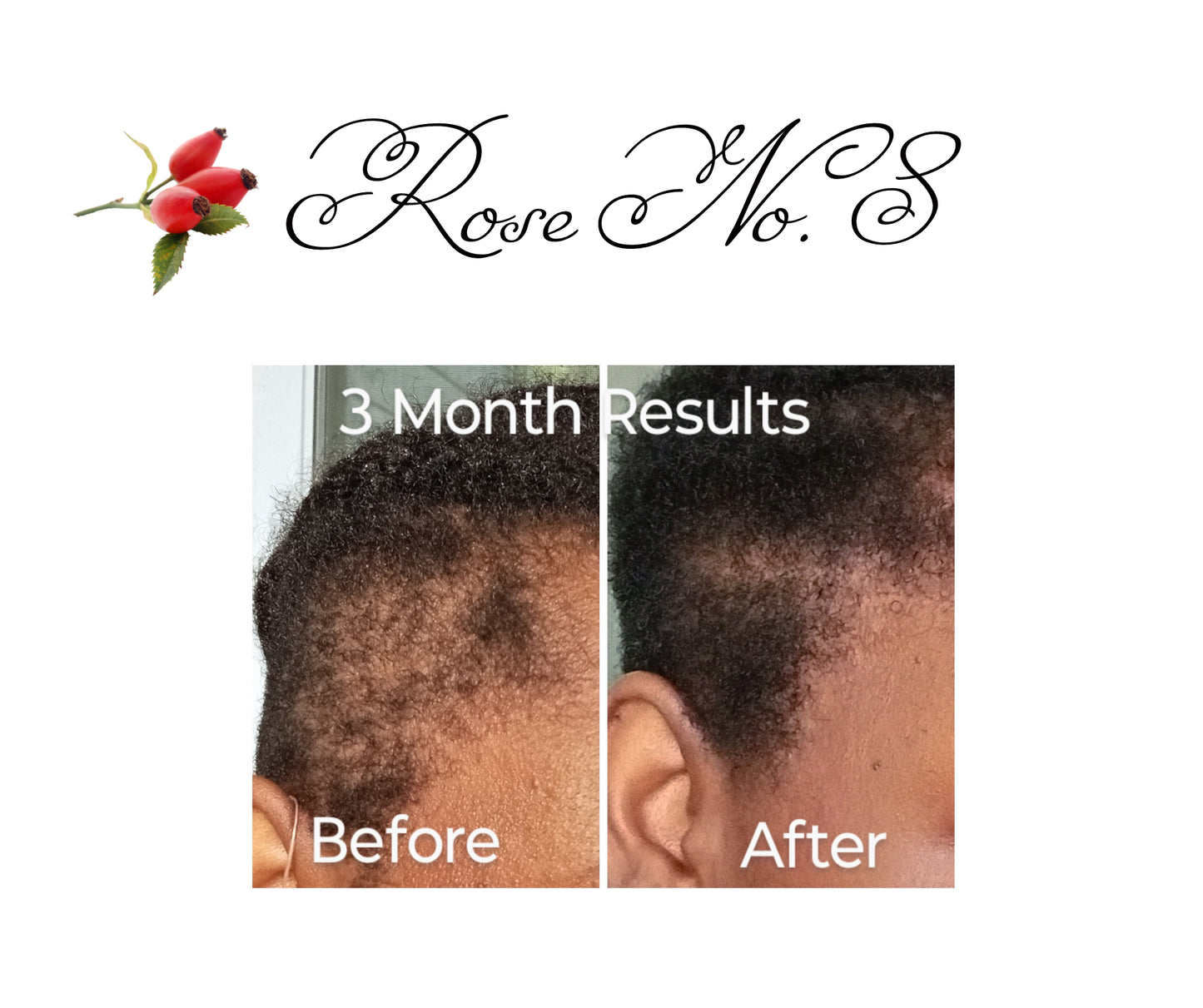Scalp & Body Treatment