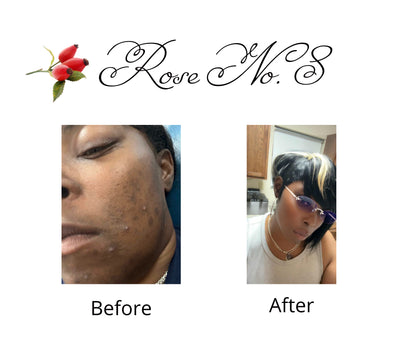 Anti-Aging Facial & Body Oil